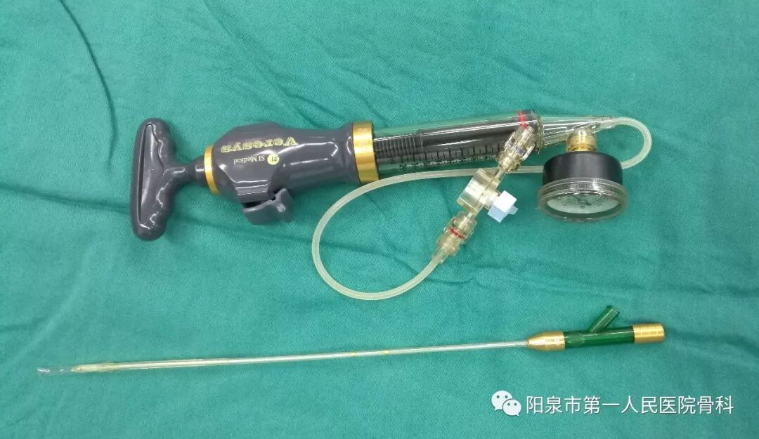 椎体成型需要哪些器材椎体成形术概述_https://www.jmylbn.com_新闻资讯_第23张