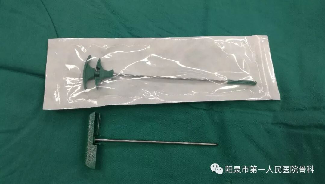 椎体成型需要哪些器材椎体成形术概述_https://www.jmylbn.com_新闻资讯_第21张
