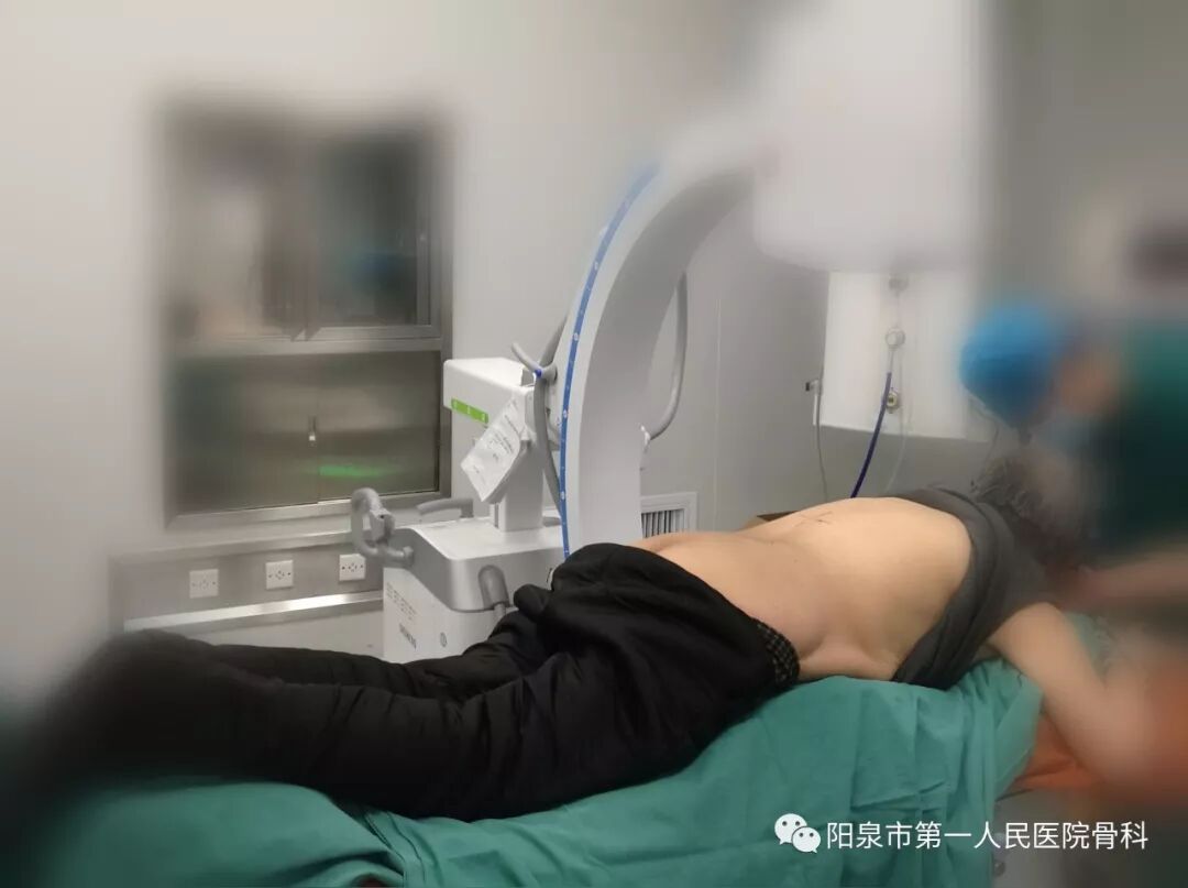 椎体成型需要哪些器材椎体成形术概述_https://www.jmylbn.com_新闻资讯_第19张
