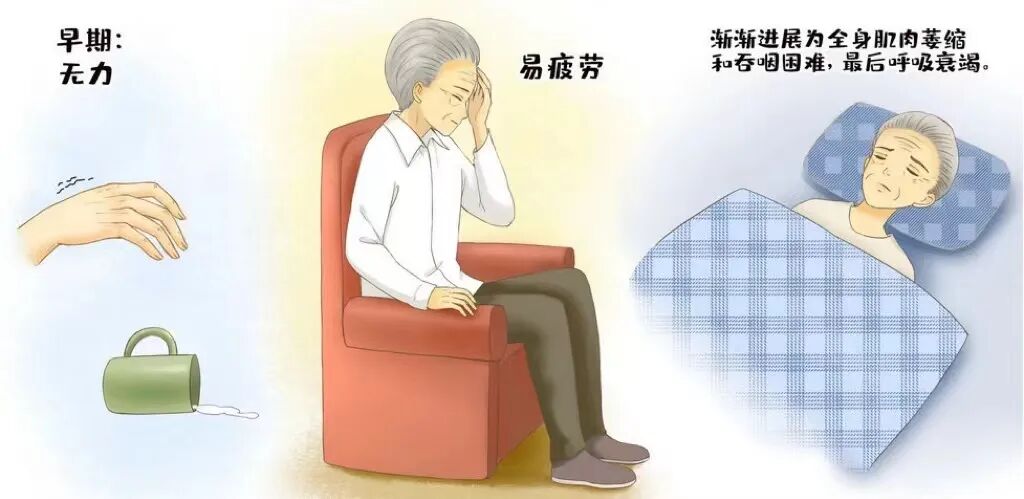 呼吸机怎么选择【健康星期天】畅快呼吸、倍感轻松——无创呼吸机的正确选择_https://www.jmylbn.com_新闻资讯_第11张