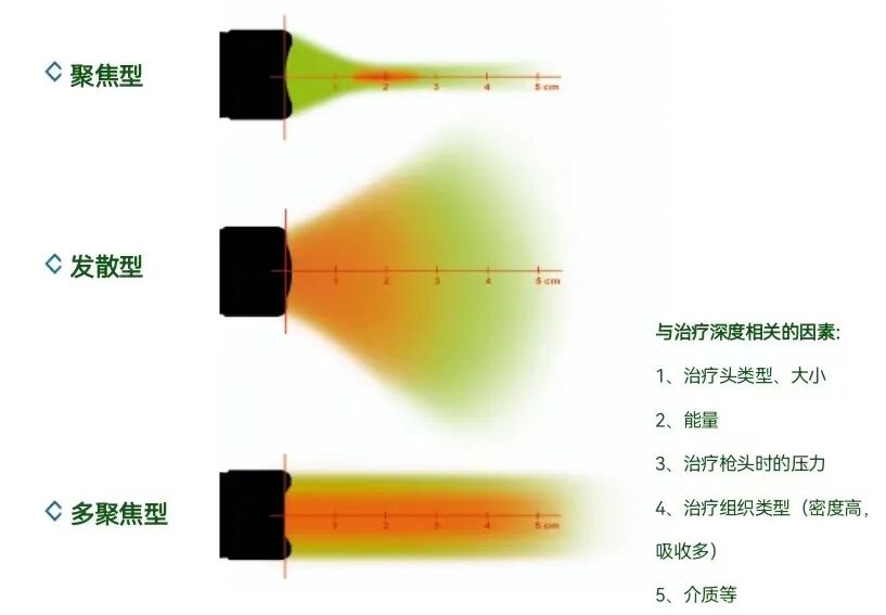 压力波是什么波关于洽圩压力波治疗仪的总结_https://www.jmylbn.com_新闻资讯_第6张