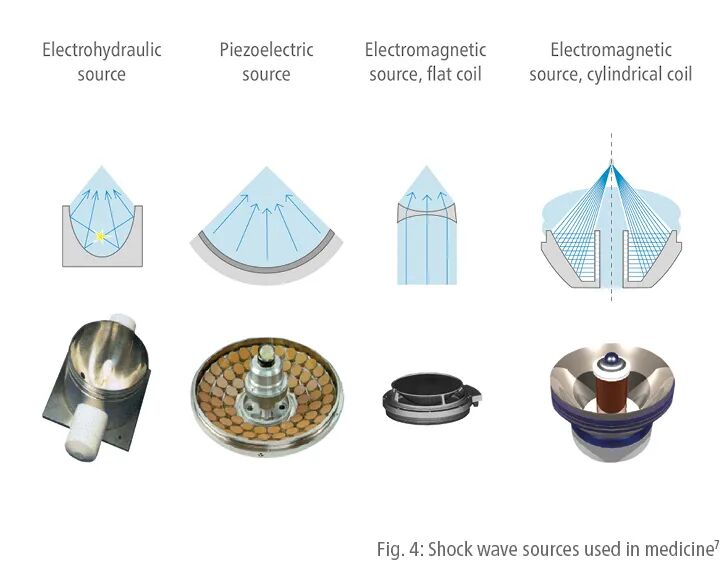 压力波是什么波关于洽圩压力波治疗仪的总结_https://www.jmylbn.com_新闻资讯_第4张