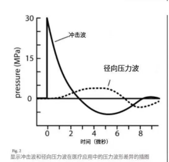 压力波是什么波关于洽圩压力波治疗仪的总结_https://www.jmylbn.com_新闻资讯_第5张