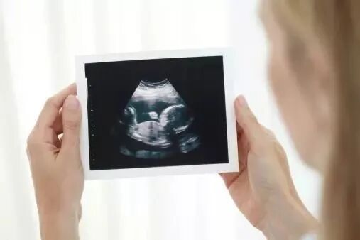 眼科ab超单怎么看1分钟带你看懂孕检B超单，解读秘籍准妈妈必备！_https://www.jmylbn.com_新闻资讯_第15张