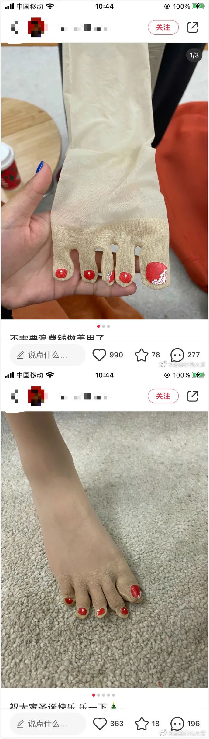 要想屁股光滑有弹性,你只需要一件神器!-微信头条网 要想屁股光滑有弹性,你只需要一件神器!