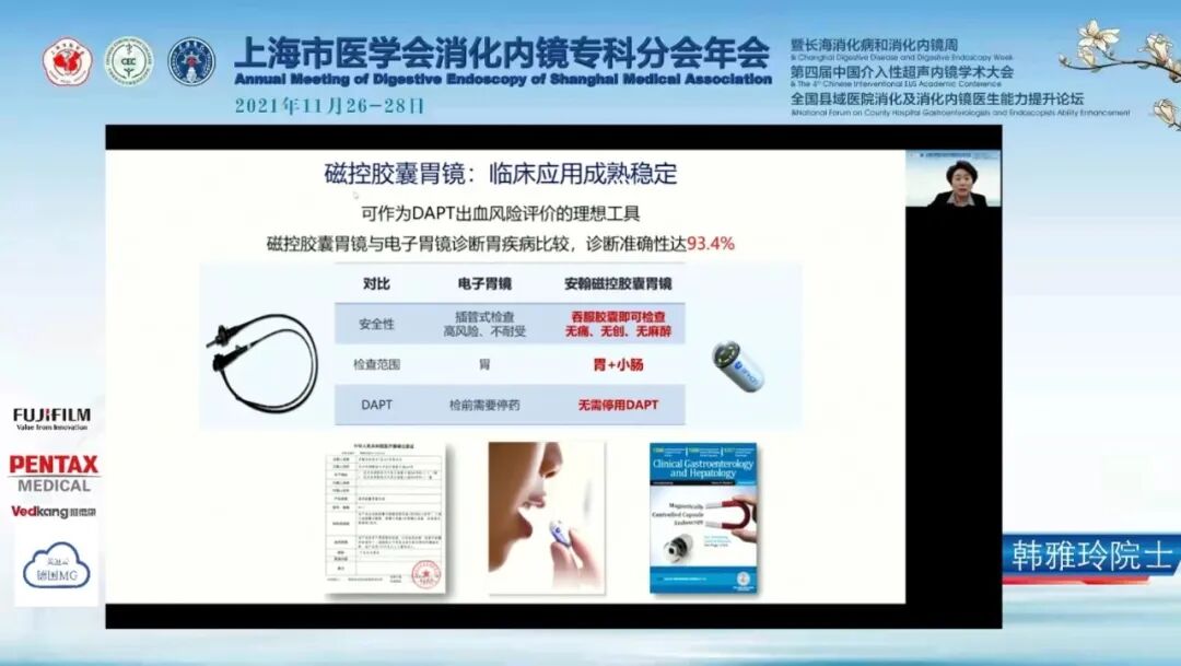 血小板660有什么危害抗血小板治疗对消化道损伤的防治——磁控胶囊胃镜跨学科应用_https://www.jmylbn.com_新闻资讯_第6张
