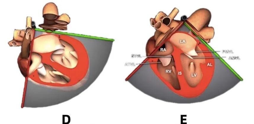 彩超探头怎么转换经食道心脏彩超（TEE）总看不懂？5 分钟掌握经典切面！（附动图）_https://www.jmylbn.com_新闻资讯_第9张