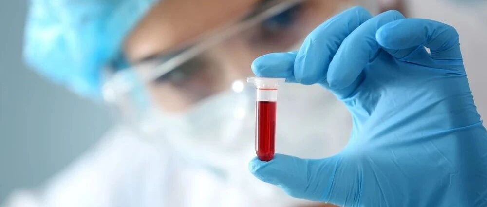 D-二聚体升高的 9 点解读，别只想到肺栓塞！