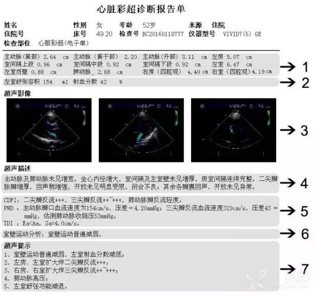 超實用！7 步讀懂超聲心動圖 健康 第1張