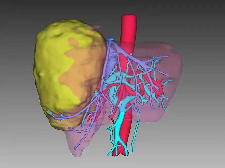 cusa刀有哪些品牌手握“Cusa”刀，心中有“雄策”，对这个“隐形杀手”他可以做到精准打击_https://www.jmylbn.com_新闻资讯_第7张