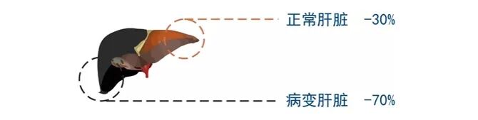 cusa刀有哪些品牌手握“Cusa”刀，心中有“雄策”，对这个“隐形杀手”他可以做到精准打击_https://www.jmylbn.com_新闻资讯_第4张