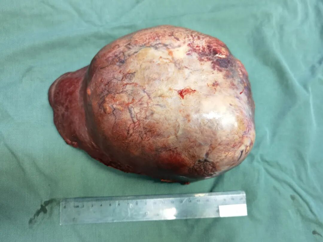 cusa刀有哪些品牌手握“Cusa”刀，心中有“雄策”，对这个“隐形杀手”他可以做到精准打击_https://www.jmylbn.com_新闻资讯_第9张