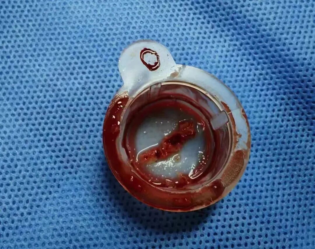 医院床位灯怎么关以心为灯，守护生命——玉田县中医医院内二科_https://www.jmylbn.com_新闻资讯_第6张