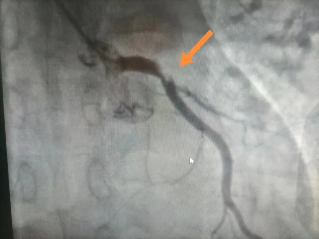 医院床位灯怎么关以心为灯，守护生命——玉田县中医医院内二科_https://www.jmylbn.com_新闻资讯_第4张