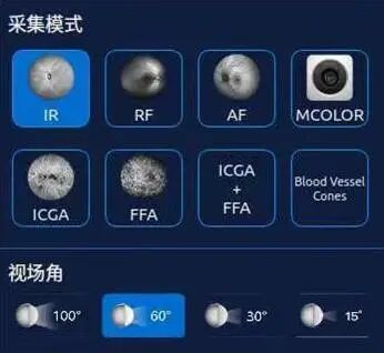 怎么看眼底相机微清Apollo相机，揭开白内障眼底的神秘面纱_https://www.jmylbn.com_新闻资讯_第14张