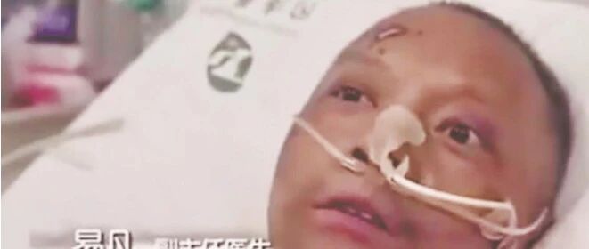 感染新冠的“黑脸”医生，白回来了！