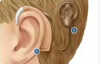 耳聋是怎样发生的