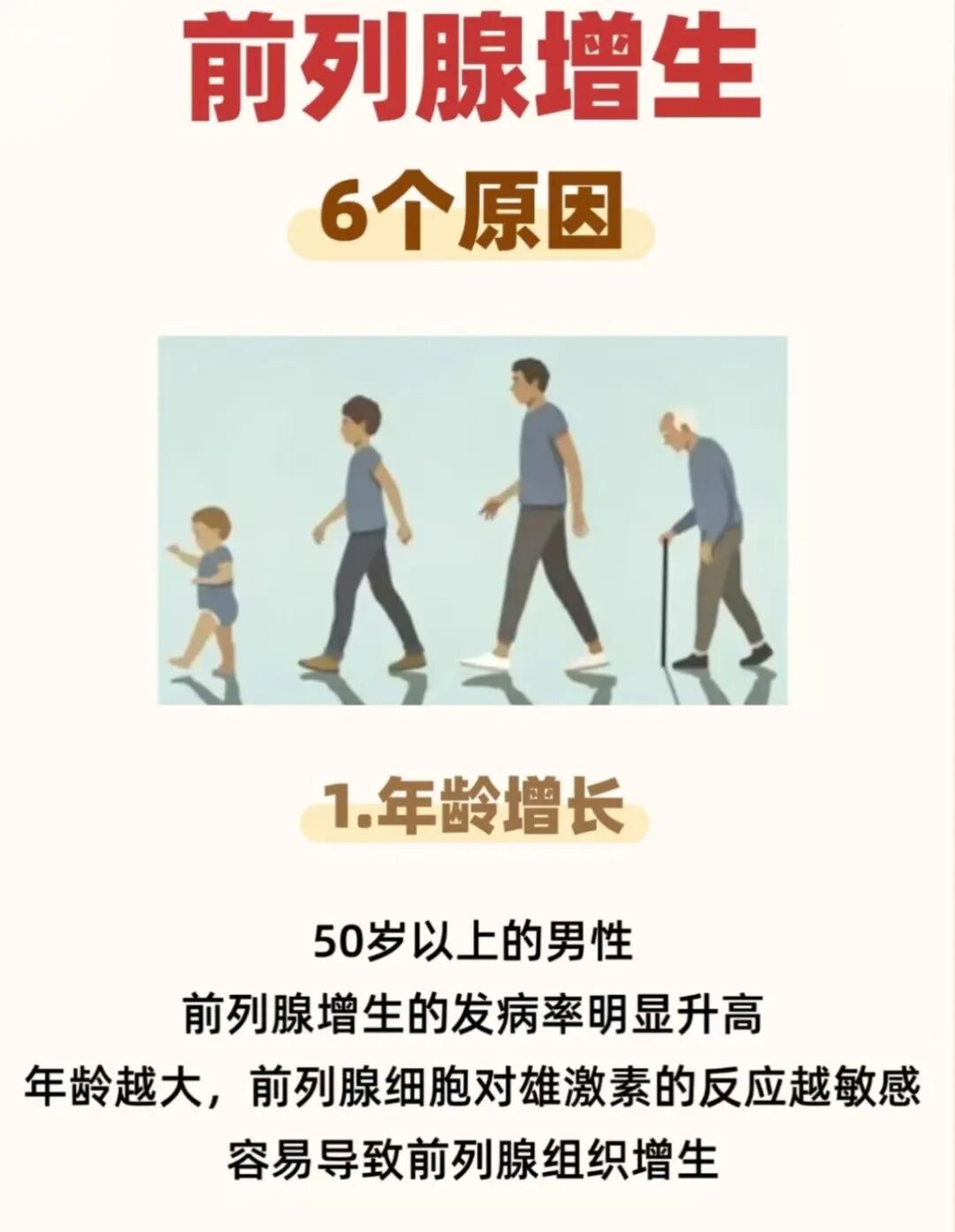 前列腺增生6个原因