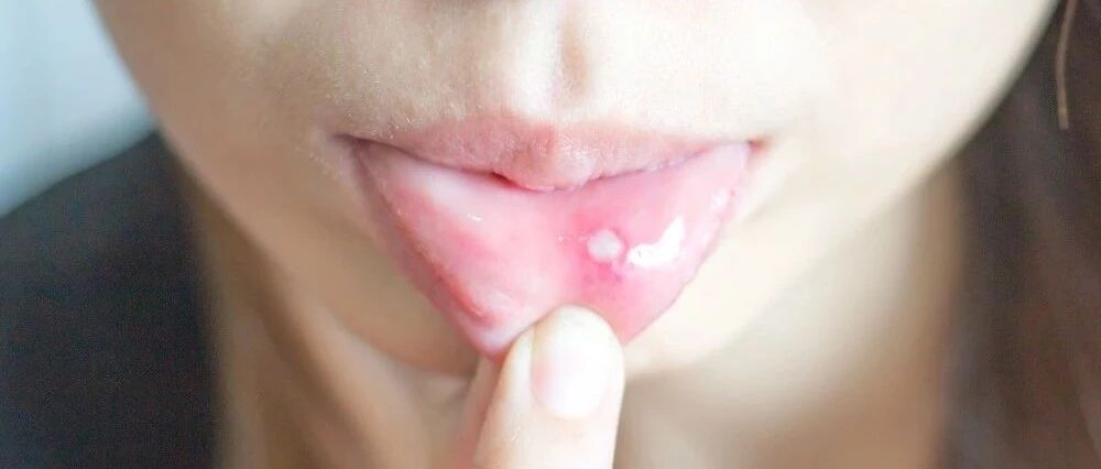 孩子嘴唇长疱是上火吗？如何护理？