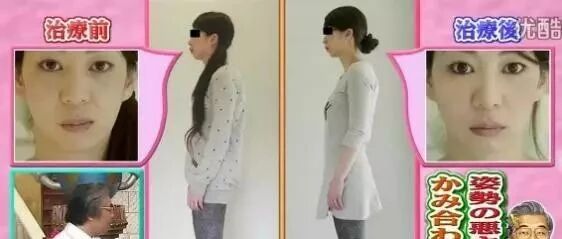 它不但让你的全身骨骼畸形位移，更让你的颜值降低