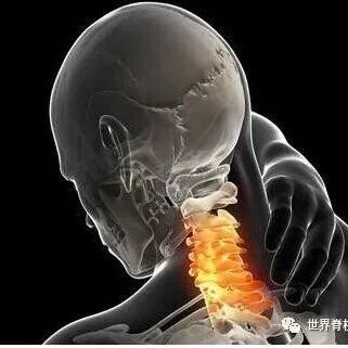 这个动作做不到，你的颈椎已经很危险了！