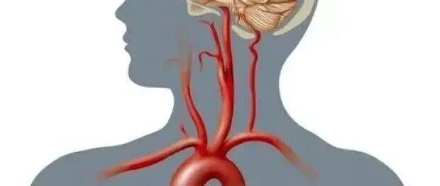 女子一个动作竟致全身瘫痪，很多人还在做！