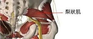 别让梨状肌背黑锅，它不是压迫坐骨神经的唯一真凶！