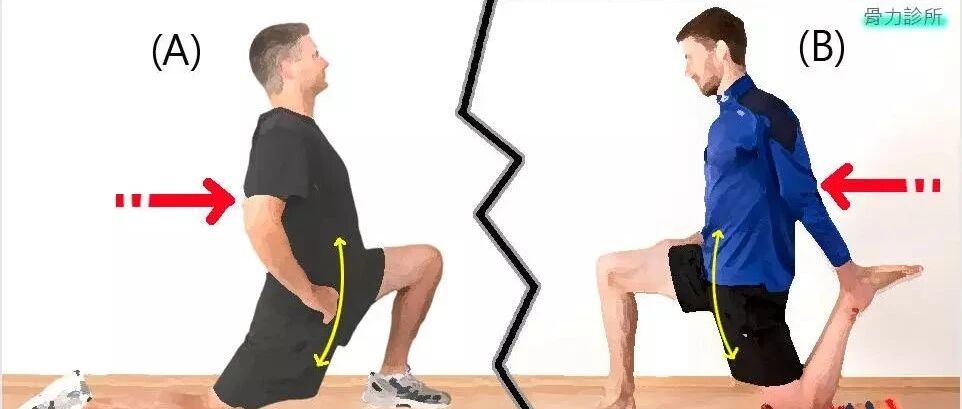 你可能已经患上髂腰肌综合症，赶紧来学学怎么处理！