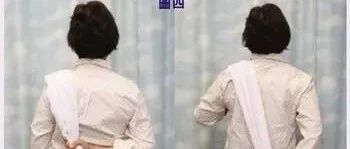 肩周炎的康复训练