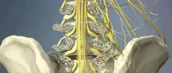 腰椎间盘突出的成因、检查、分型、表现及康复训练方案