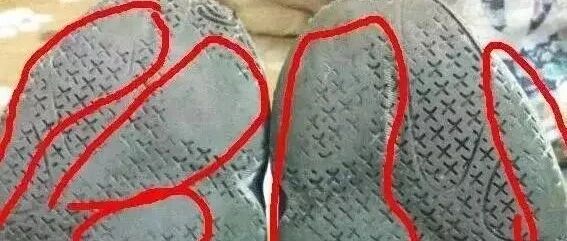 鞋底的磨损状况能反映身体的疾病状况？