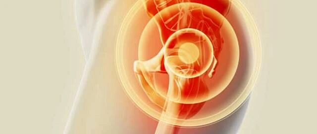 这不是翘臀，是骨盆前倾！