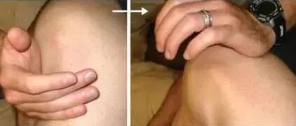 肩锁关节功能检查及关节松动操作