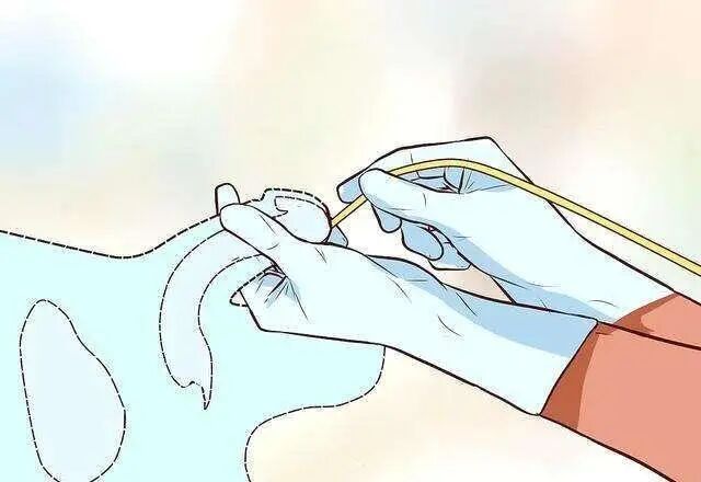 为什么要引流尿袋做手术插尿管，这种感觉“酸爽”吗，需要注意哪些问题？_https://www.jmylbn.com_新闻资讯_第18张