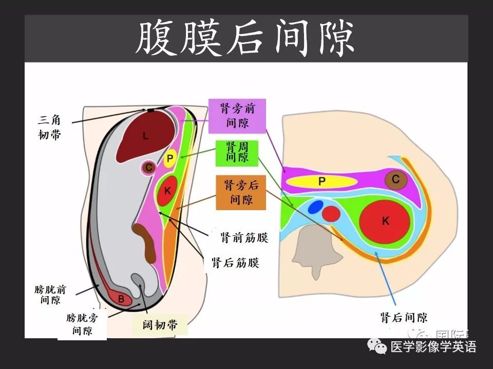 遊離氣體是由腹部臟器穿孔所致,常見於胃/十二指腸潰瘍或憩室炎穿孔