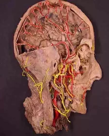 死尸工厂_尸体工厂_尸骨工场