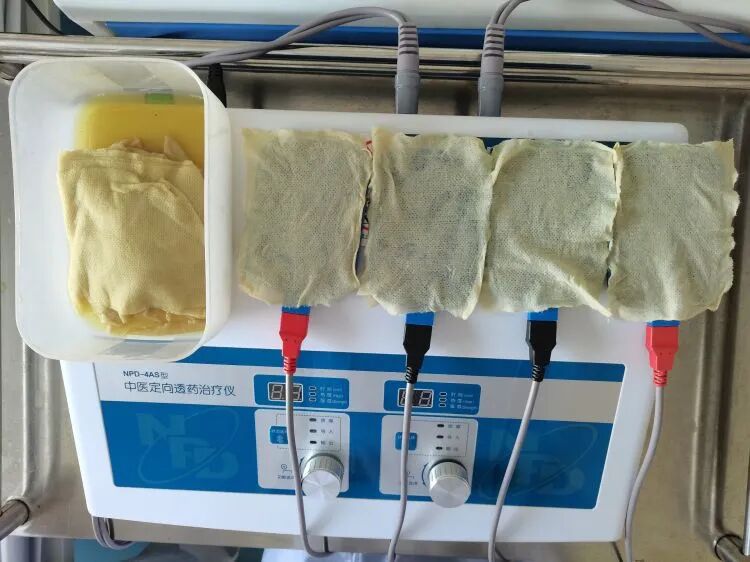 中医定向透药用什么药【灵中医丨特色治疗】疼痛三科：不打针、不吃药的中医定向透药治疗_https://www.jmylbn.com_新闻资讯_第4张