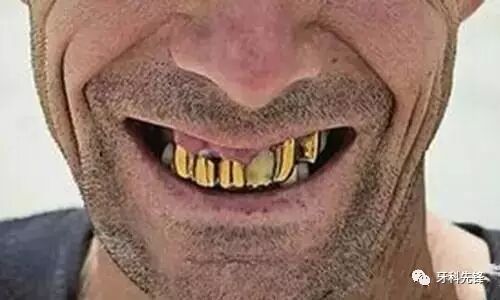 洗牙不贵，但为什么很多人却不愿意洗牙？