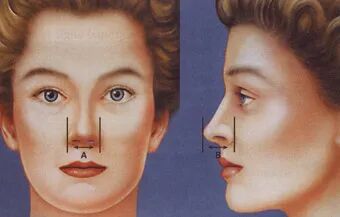 【科普】秋天，鼻子保健进行时！