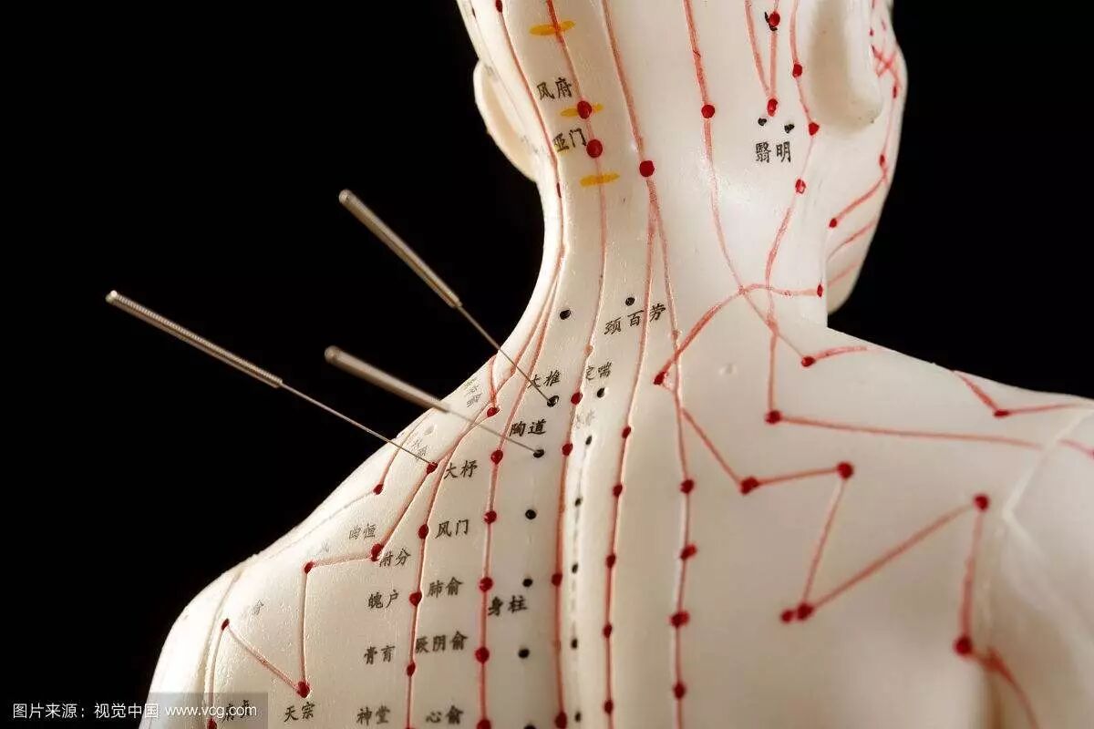 针灸有什么副作用?