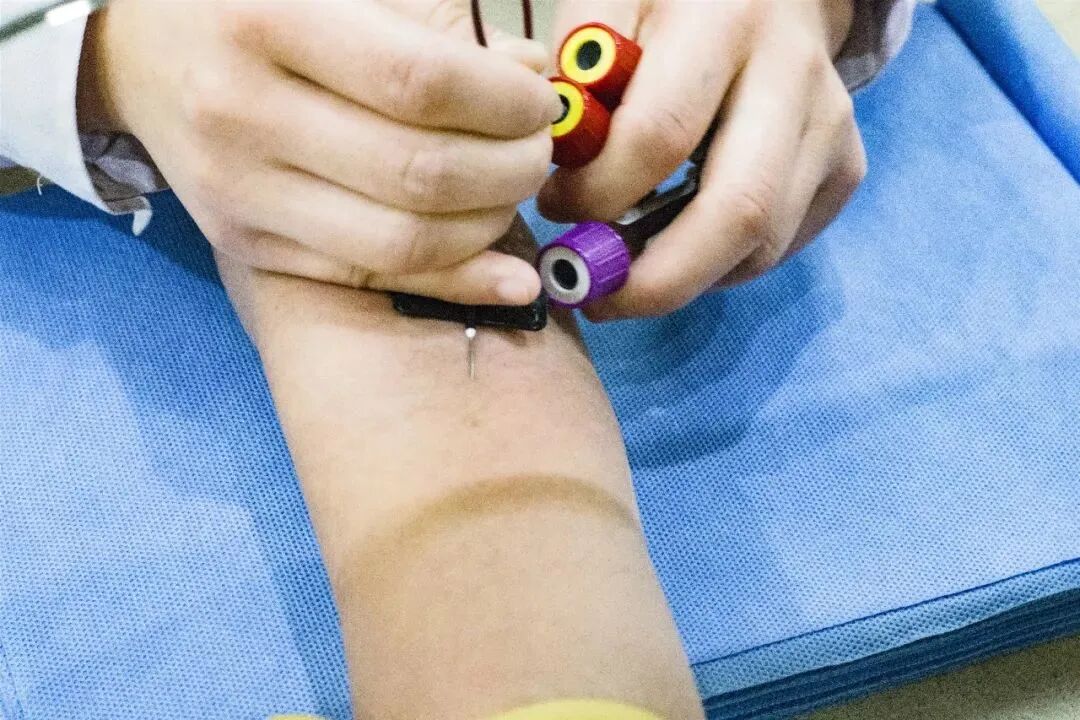 一次性采血针怎么用朱氏耗材 ｜ 一次性使用静脉采血针知多少？_https://www.jmylbn.com_新闻资讯_第6张