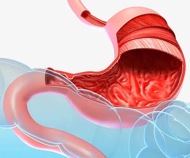 一次性胃管干什么用的朱氏风物 ｜ 东贝一次性使用胃管，不辜负美食的乐趣_https://www.jmylbn.com_新闻资讯_第2张