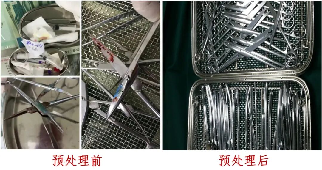 医疗器械怎么处理消毒供应中心专栏 ｜ 强化安全，守护健康——关注临床复用医疗器械的预处理_https://www.jmylbn.com_新闻资讯_第5张