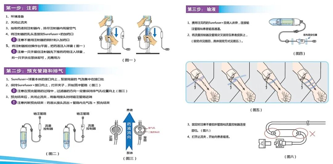 化疗为什么用泵​精准把控 “泵”向安心——鄂州市中医医院肿瘤科精准使用便携式化疗泵  让轻松化疗成为现实_https://www.jmylbn.com_新闻资讯_第3张
