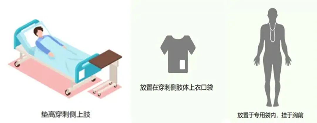 化疗为什么用泵​精准把控 “泵”向安心——鄂州市中医医院肿瘤科精准使用便携式化疗泵  让轻松化疗成为现实_https://www.jmylbn.com_新闻资讯_第5张