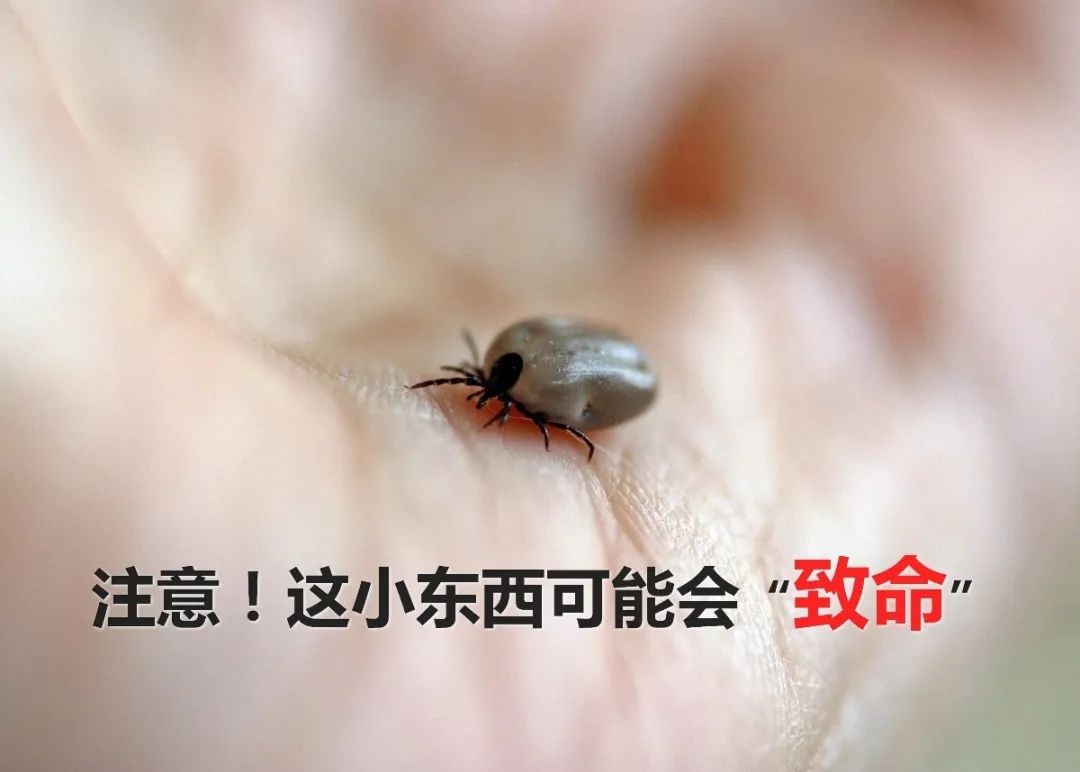 疾控在高烧老人家中找出近200只蜱虫