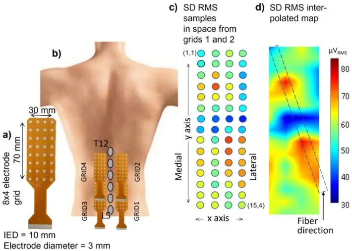 康复大学周平教授团队高密度表面肌电信号分解综述