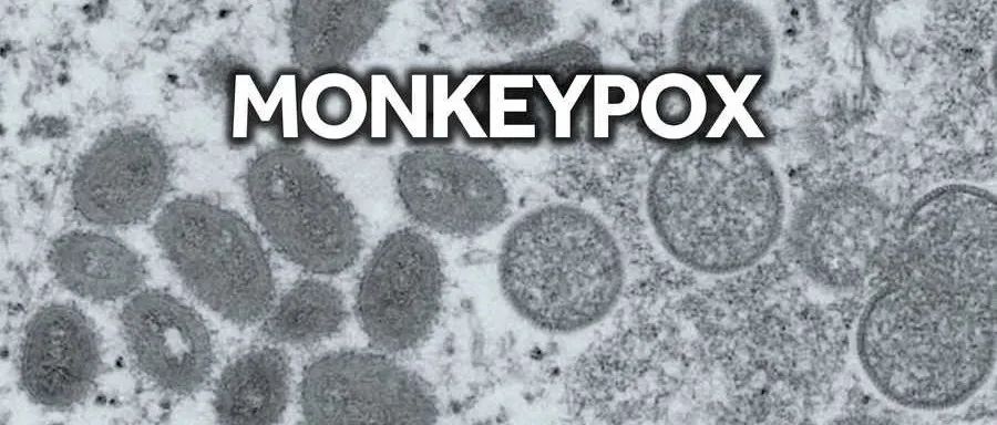 截至昨天，堪萨斯州已有两例猴痘感染者，密苏里州累计有12例