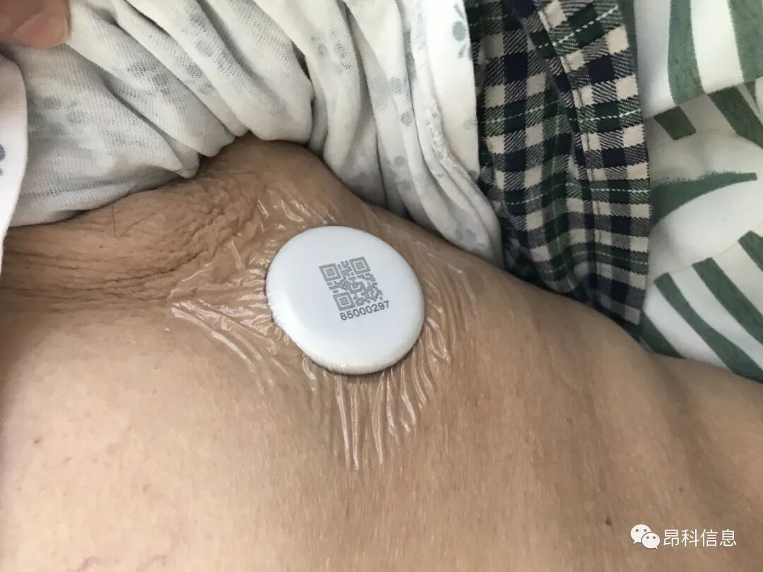 昂科  智慧養(yǎng)老 老人防走失  老人監(jiān)護