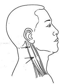 神经丛刺激针是什么各种麻醉神阻法详解！推荐收藏！_https://www.jmylbn.com_新闻资讯_第5张